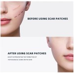 Medical Scar Tape Supplier - Keloid Cesarean Section Care