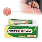 Eczema Cream Supplier - Chinese Herbal Skin Itching