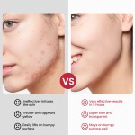 Acne Repair Cream Factory - Stubborn Acne Spots Soothing