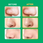 Blackhead Removal Patch Supplier - Facial T-zone Water Glue