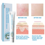 Sulfur Ointment Supplier - Topical Skin Antipruritic Antibacterial