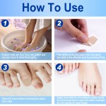 Nail Fungus Cream Supplier - Onychomycosis Treatment Ointment
