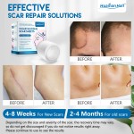 Medical Scar Sheets Manufacturer - Waterproof Hydrates Self-Adhesive