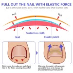 Nail Treatment Patch Factory - Anti Fungal Ingrown Toenail