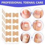 Nail Treatment Patch Factory - Anti Fungal Ingrown Toenail