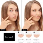 Hydrocolloid Acne Patch Factory - Transparent Pimple Treatment