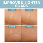 Scar Dressing Manufacturer - Medical Grade 4x15cm Universal