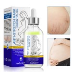 Stretch Mark Oil Factory - 30mL Olive Oil Skin Hydrating