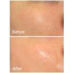 Hyaluronic Acid Supplier - Plant Extract Skincare Care