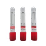 Non-Vacuum Blood Tube with Gel Separator & Clot Activator (PP 1-4ml, 13 * 75mm)