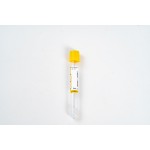 Non-Vacuum Blood Tube with Gel Separator & Clot Activator (PP 1-4ml, 13 * 75mm)