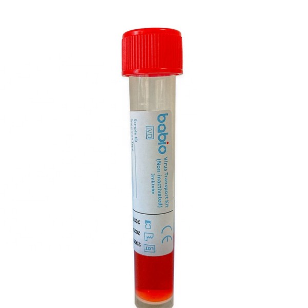 Disposable Virus Sampling Tube Nose Swab Throat Swab Virus Storage Solution Sampling Swab Set