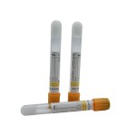 Non-Vacuum Blood Tube with Gel Separator & Clot Activator (PP 1-4ml, 13 * 75mm)