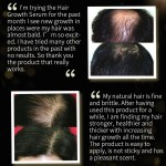 Customized 30ml Pure Natural Black Rice Hair Growth Oil for Alopecia Population Hair Regrowth Treatments