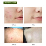 Best Quality Handmade Papaya Brightening Skin Lightening Bathing Toilet Whitening Turmeric Kojic Acid Soap