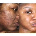 Cheap Factory Price Herbal Whitening Private Label Face Acne Treatment Turmeric Soap