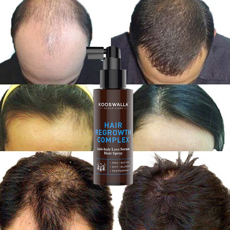 OEM ODM Private Label 100% Herbal Natural Formula Wholesale Anti Hair Loss and Hair Growth Spray