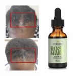 Private Label 100% Pure Organic Natural Hair Growth Oil Fast Growth Hair Rosemary Oil Hair Loss Treatment