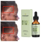 Kooswalla Organic Herbal Rosemary Essential Oil Vegan Home Care Hair Growth Oils for Shiny Hair Pure and Natural