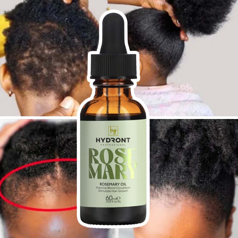 Organic Rosemary Castor Hair Oil Refreshing and Hair-Repairing Private Label Scalp Nourishing Product for Growth