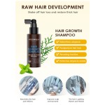 OEM ODM Private Label 100% Herbal Natural Formula Wholesale Anti Hair Loss and Hair Growth Spray