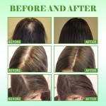 Scalp Oil Supplier - Rosemary Biotin Treatment