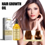 Scalp Oil Supplier - Rosemary Mint Biotin