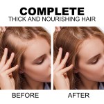 Hair Growth Spray Manufacturer - Black Rice Repair