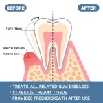Gum Drops Supplier - 30ml Multi-Purpose