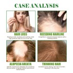 Scalp Oil Supplier - Rosemary Biotin Treatment