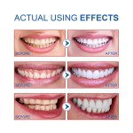 Toothpaste Manufacturer - Probiotic Whitening