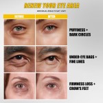 Eye Tightener Supplier - Dark Circles Removal