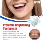 Toothpaste Manufacturer - Probiotic Whitening