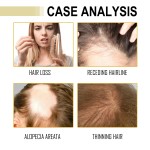 Scalp Oil Supplier - Rosemary Mint Biotin