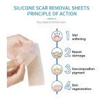 Silicone Scar Patch Factory - Gel Removal Economic