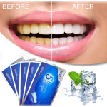 Teeth Whitening Strips Supplier - 28pcs OEM Custom