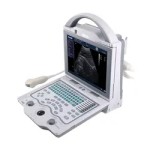 Portable Ultrasound Machine Supplier - KX-5600 B Mode