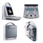 Portable Ultrasound Machine Supplier - KX-5600 B Mode