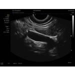 Laptop Ultrasound Scanner Manufacturer - SS-9B B/W Notebook