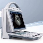Portable Ultrasound Machine Supplier - KX-5600 B Mode