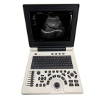 Laptop Ultrasound Scanner Manufacturer - SS-9B B/W Notebook