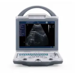 Portable Ultrasound Machine Supplier - KX-5600 B Mode