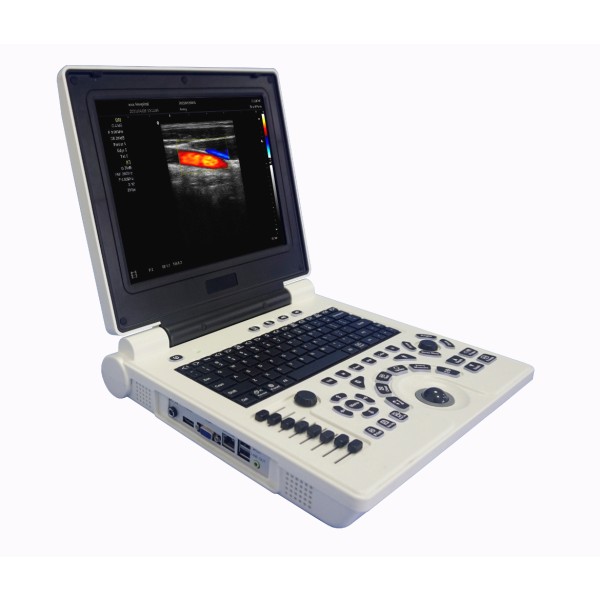 Color Doppler Ultrasound Supplier - C2 Laptop Portable