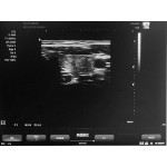 Laptop Ultrasound Scanner Manufacturer - SS-9B B/W Notebook