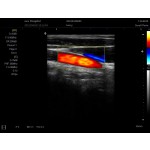 Color Doppler Ultrasound Supplier - C2 Laptop Portable