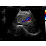 Color Doppler Ultrasound Supplier - C2 Laptop Portable