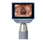 Video Laryngoscope Supplier - Medical Visual Disposable