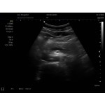 Laptop Ultrasound Scanner Manufacturer - SS-9B B/W Notebook