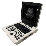 Laptop Ultrasound Scanner Manufacturer - SS-9B B/W Notebook