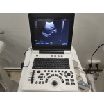 Color Doppler Ultrasound Supplier - C2 Laptop Portable